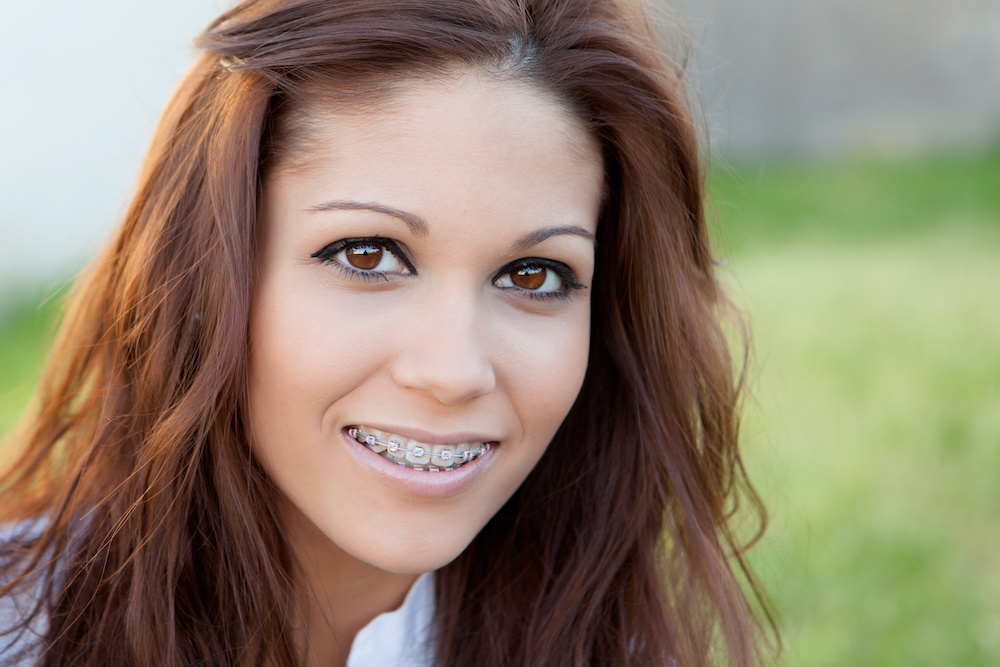 Learn how to fix your braces in Midlothian