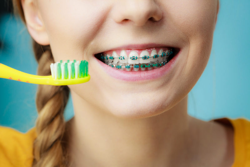 How Can I Avoid Gum Disease When I Have Braces? Dabney Orthodontics