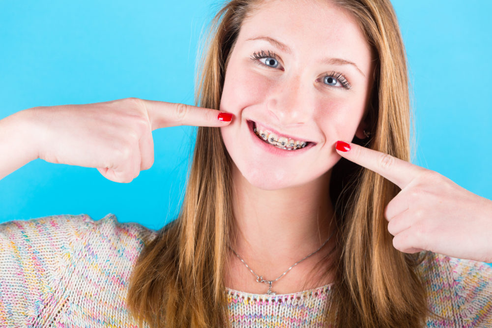 Smiling Beautiful Girl with Braces on Blue Background