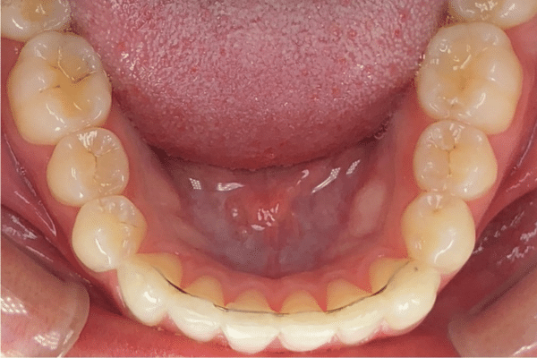 ProWire-Image-Case-Completed_600x400