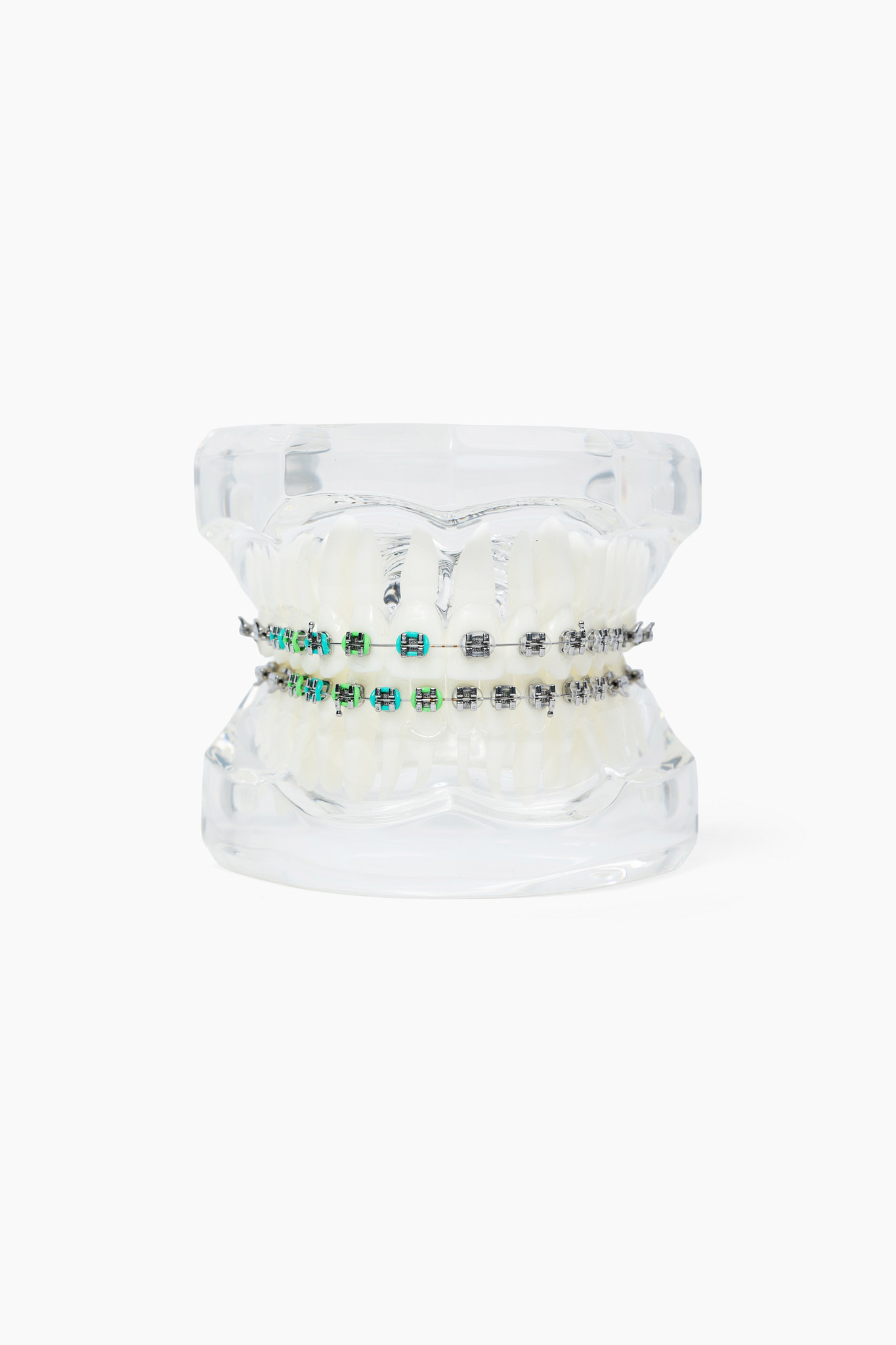 LightForce Orthodontics_r1_03D_6624