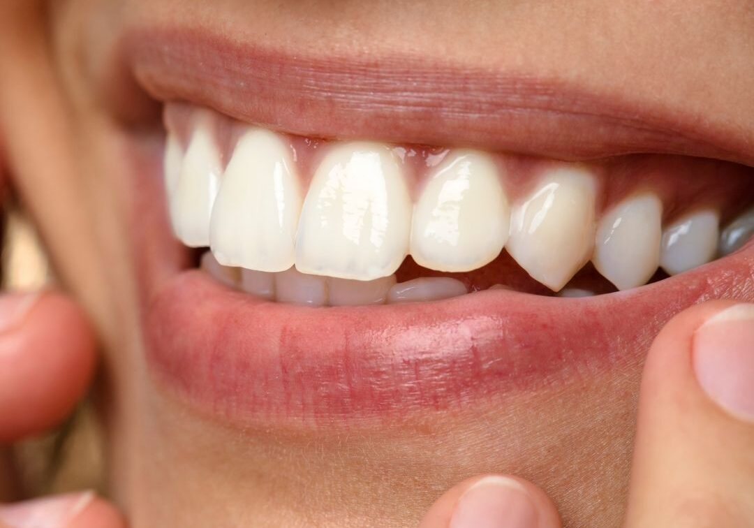 DABNEY Cosmetic Dental & Dentists POST Templates